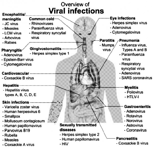 Draw the structure of overview of viral infections. Sarthaks eConnect