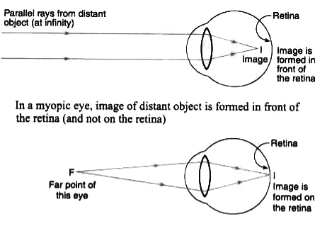 far point of eye