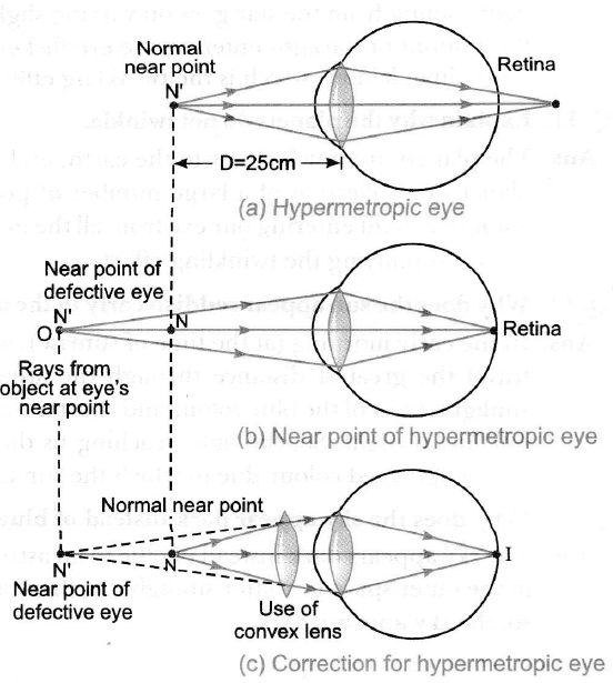 far point of eye