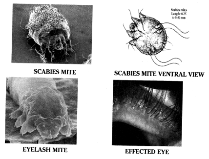 Collect different pictures of micro arthropods. - Sarthaks eConnect